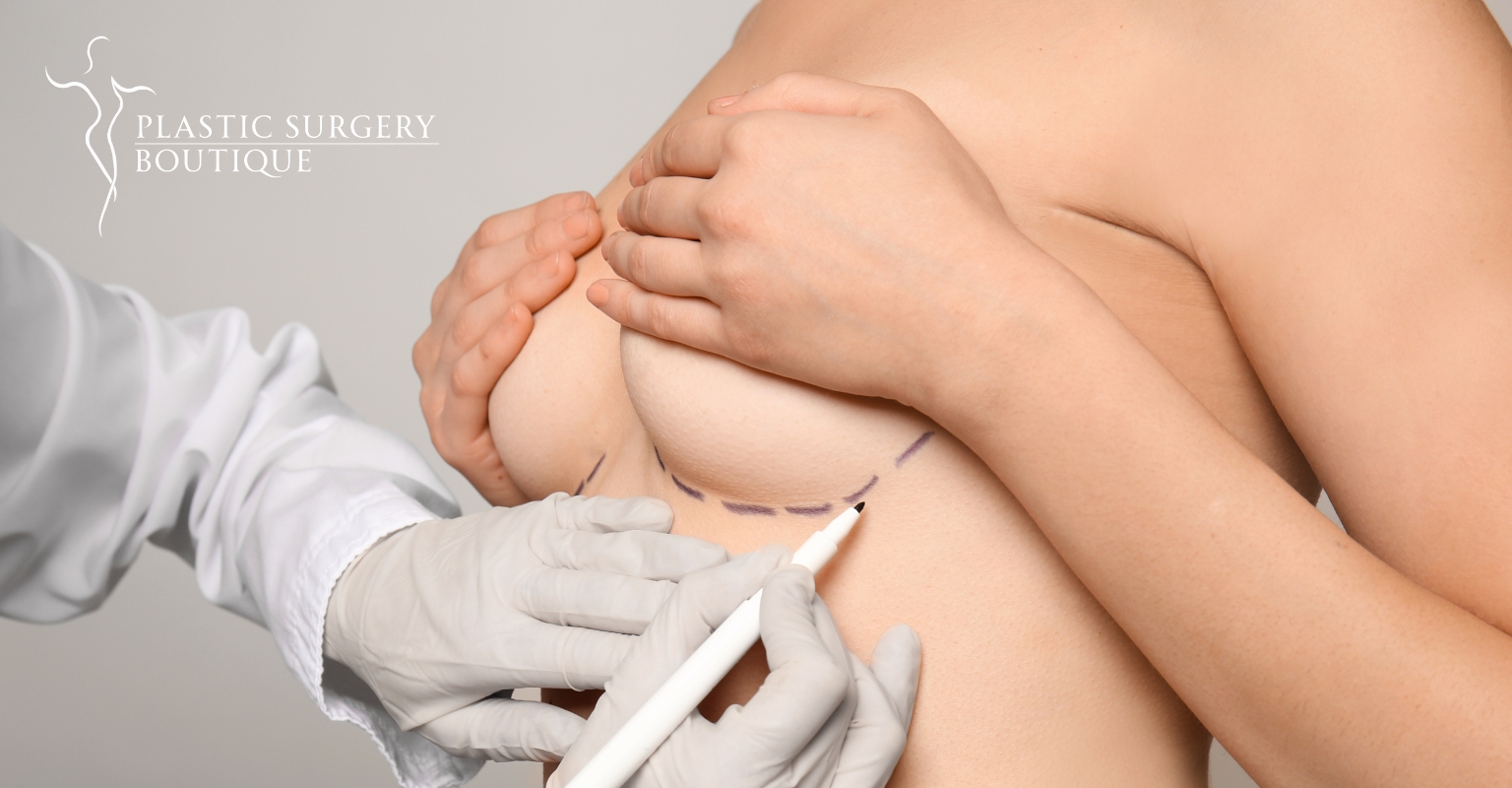 The Ultimate Guide to Breast Augmentation in Miami with Dr. Sophie
